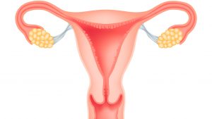 Мазня вместо месячных: причины выделений во время менструации