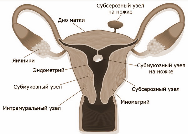 Форма матки